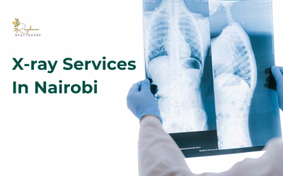 Comprehensive Guide to X-Ray Services in Nairobi: Types, Uses, and What to Expect