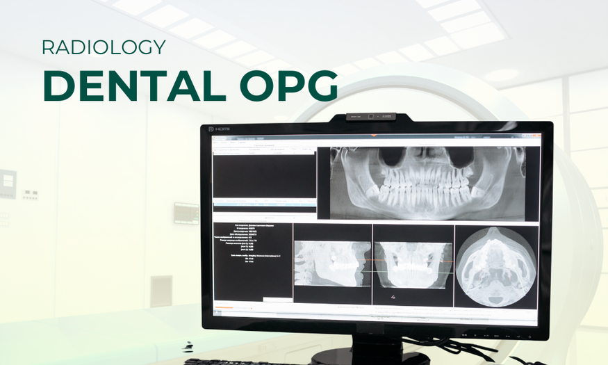 Dental OPG in Nairobi