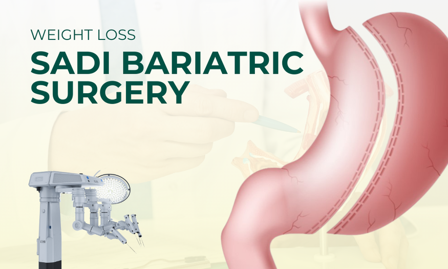 Sadi bariatric weight loss Surgery in Kenya