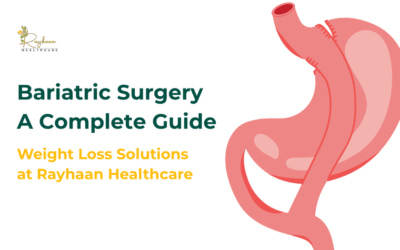 Bariatric Surgery: A Complete Guide by Rayhaan Healthcare