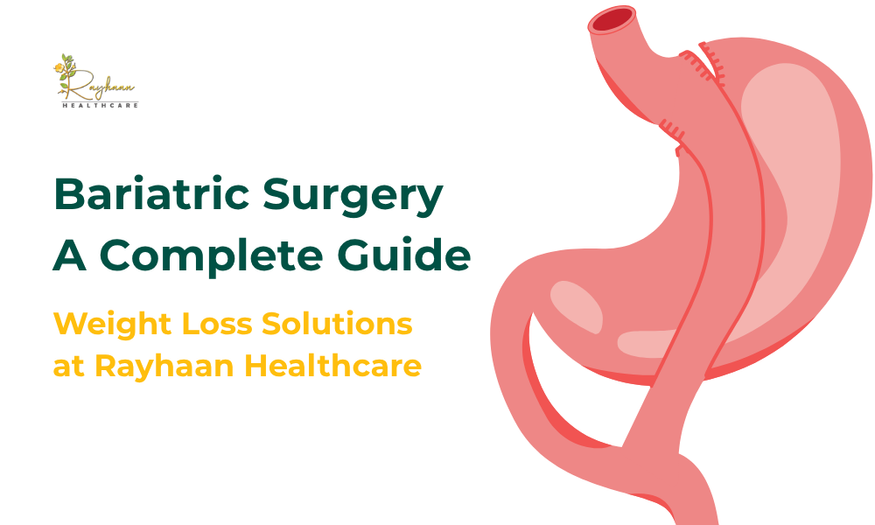 Bariatric Surgery: A Complete Guide by Rayhaan Healthcare