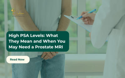 High PSA Levels: What They Mean and When You May Need a Prostate MRI