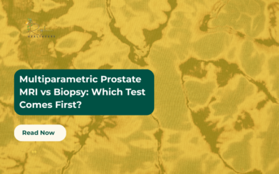 Multiparametric Prostate MRI vs Biopsy: Which Test Comes First?