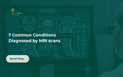 7 Common Conditions Diagnosed by MRI Scans in Kenya