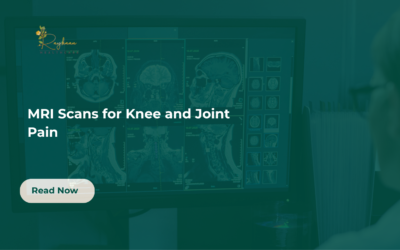 MRI Scan for Knee and Joint Pain in Nairobi: A Complete Patient Guide