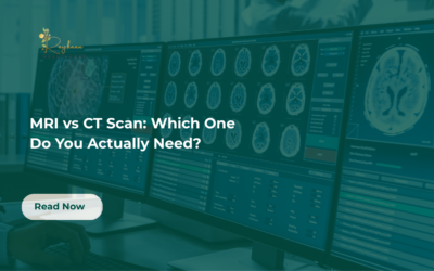 MRI or CT Scan: Which One Do You Actually Need?